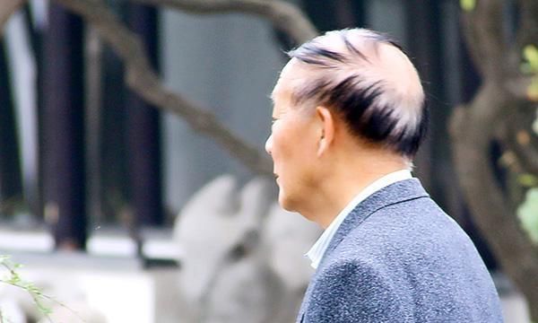 紫外线|为何有人40岁长满老年斑,而有人60岁也没长,皮肤还白净?