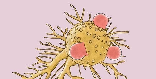 死里逃生|女子肺癌7年,两次发生转移,都死里逃生,她的抗癌方法值得学习