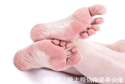 血液循环|医生直言:糖尿病来临,腿脚会出现3种“异常”,再不控糖就晚了