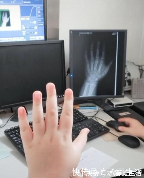 骨龄|9岁娃骨龄已13岁,医生痛心斥责,父母干啥吃的还有父母不在意