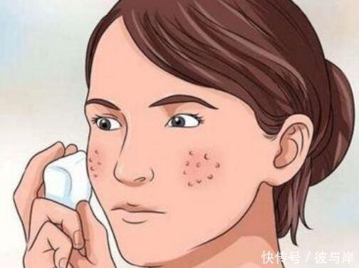 痘印反复留,一直消不掉?医生:3种方法祛痘印必用