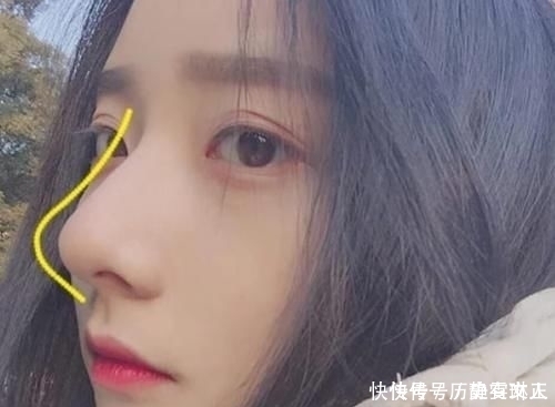 鼻子上挤出“白色条状物”学会这3招,或与“草莓鼻”说拜拜呦