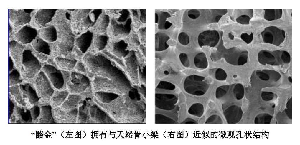 出厂价|放弃集采江苏三市营收为0，“两票制”下奥精医疗恐动刀经销商