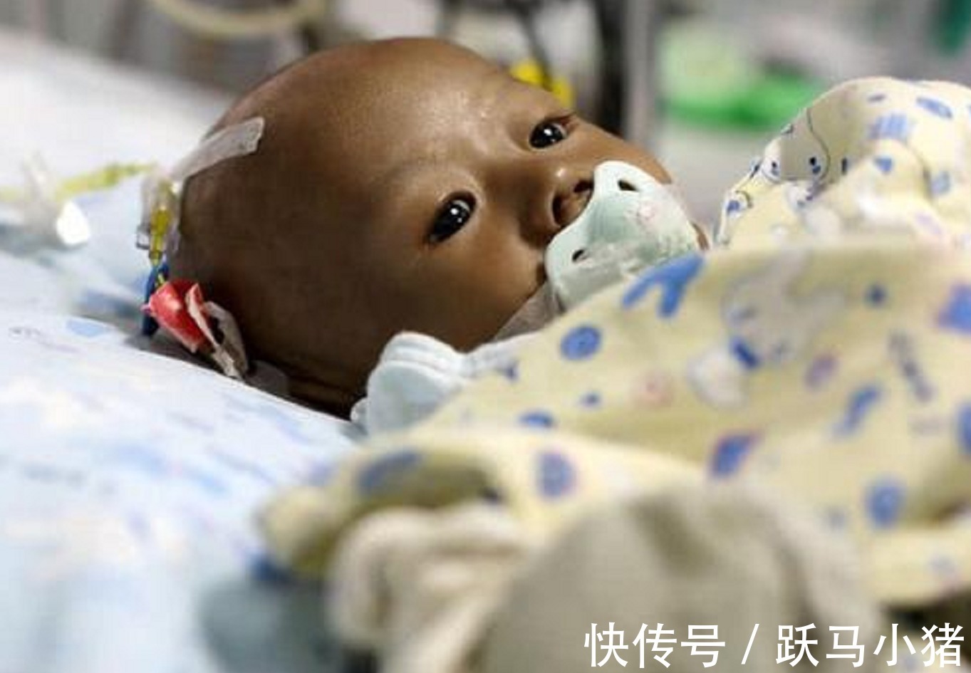 缺陷|“袖珍丈夫”走红，和妻子牵娃上街，路人问宝妈3个都你生的