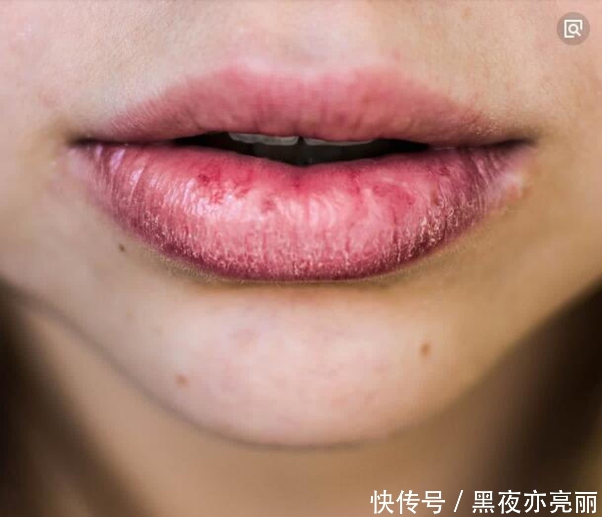 单身|有这几个特征的女生,男生第一眼就觉得丑,怪不得你单身