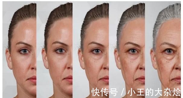 面部 做过3次线雕的她,为什么还要跑来做拉皮手术!