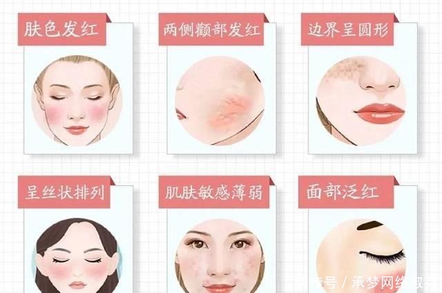 激素脸|为什么很多女生不护肤反而皮肤更好?坚持做这3件事,皮肤都不差