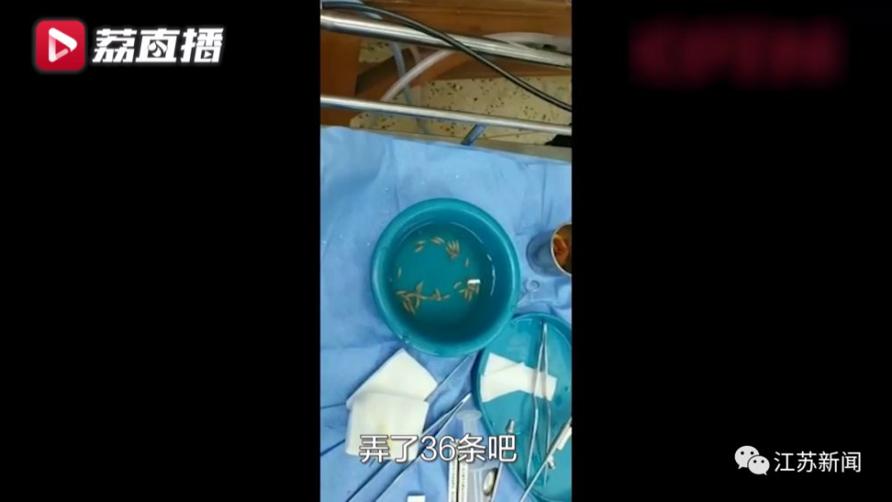 鼻子|八旬大爷鼻子发痒,医生竟从里面取出36条蛆