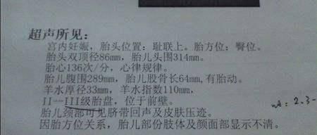 性别|孕期说有这几个信号,腹中的胎儿,十有八九是个小千金