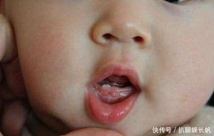 顺序|图解宝宝长牙时症状和顺序,你的宝宝掉队了吗?