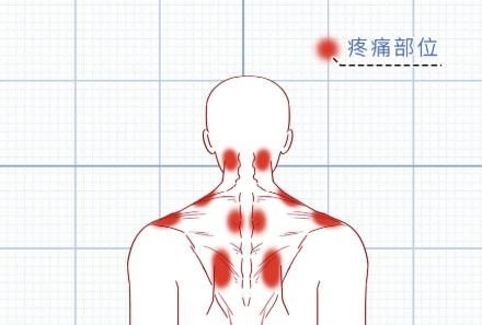 红血丝|不停打嗝、眼睛出现红血丝......这些小毛病其实非常危险