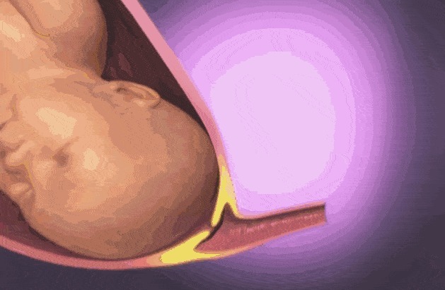 宫口|顺产到底有多疼,给你们看完这18图片,就能真正理解女人不容易