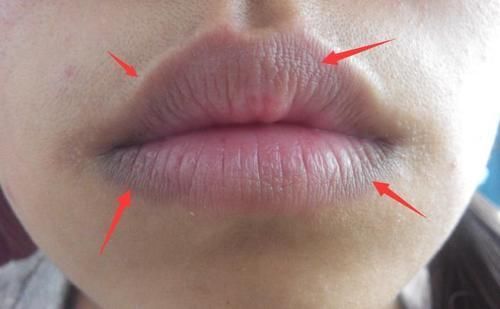 血脂|吃一口等于5斤芹菜,医生呼吁:血液粘稠常吃,清血管降血脂,血管会更好