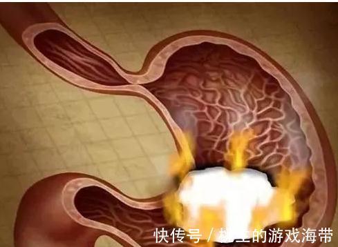 南瓜|胃有“7怕”!医生提醒:多吃“3黄”,做好“3事”,胃越来越好