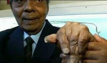 变化|大爷剪掉留了44年长指甲,捐给博物馆,不料指甲剪掉后发生了变化