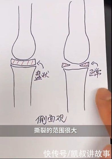 萱萱|4岁孩子一个动作导致高位截瘫！6岁以前别轻易给孩子报这些兴趣班