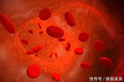 血管堵塞|老年人血管抵抗力下降，不妨做好4件事，让血管恢复弹力，不淤堵