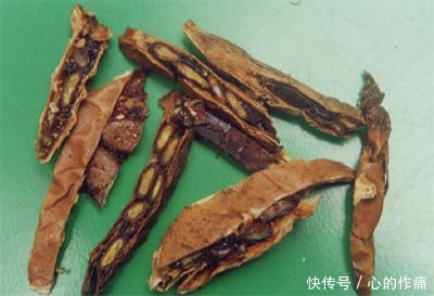  胃炎|张仲景有个小方子，“抽出”胃中痰热化解胃疼、胃炎、干呕