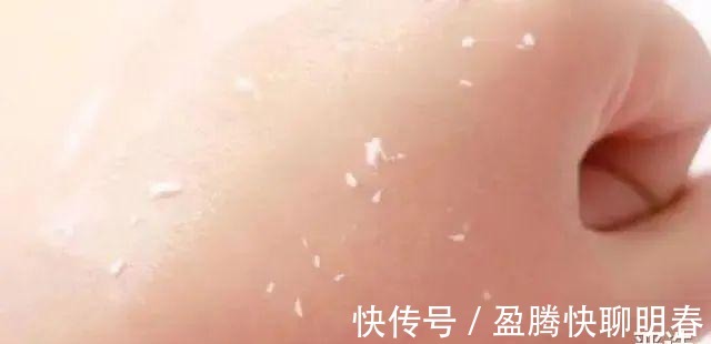 薇娅|能让李佳琦和薇娅看得上,这韩国去角质凝胶,实力真的很强大