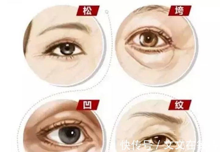 防晒 眼周护肤,到底怎么保养才有效!