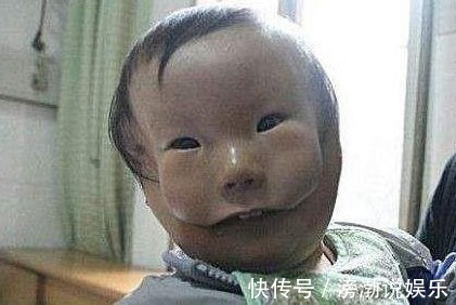 怀孕|怀孕20周,四维彩超却发现胎儿畸形,闻到孕妇身上的味道明白了