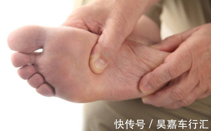 脚部|血脂高不高,看脚就知道,若没有这4种症状,恭喜,血管还算通畅