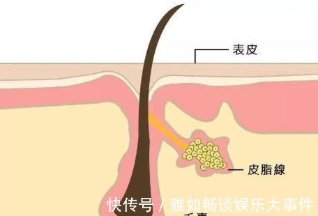 夏日|油头细软塌必看心得！夏日必不可少的“吸油纸”洗发水，孕妇可用