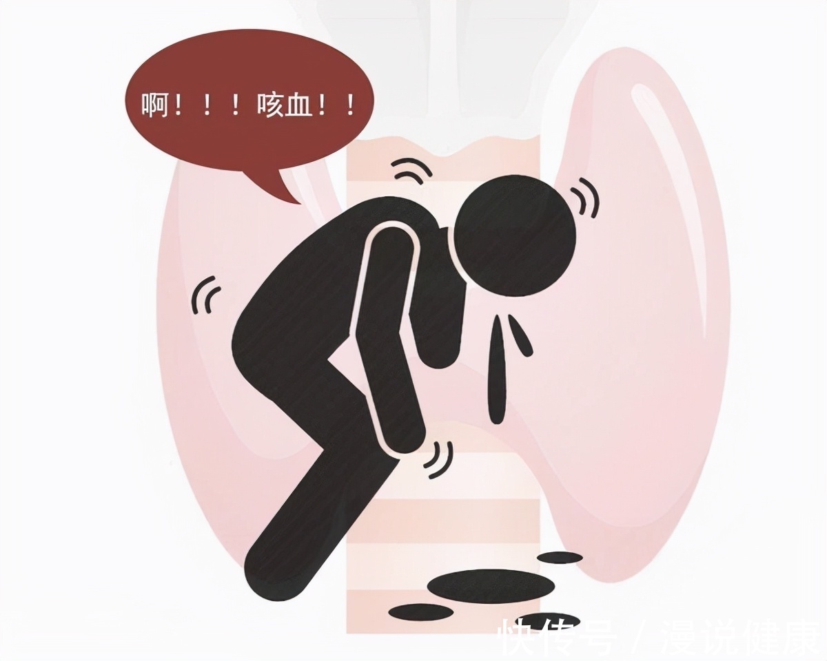 甲状腺|甲状腺结节高发,只因吃碘盐过多?这4点才是最终的“罪魁祸首”