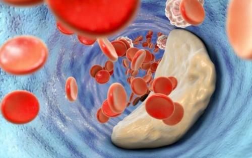 血管|血栓也有“怕”之物？不是洋葱，若经常吃，或能养护血管、防血栓