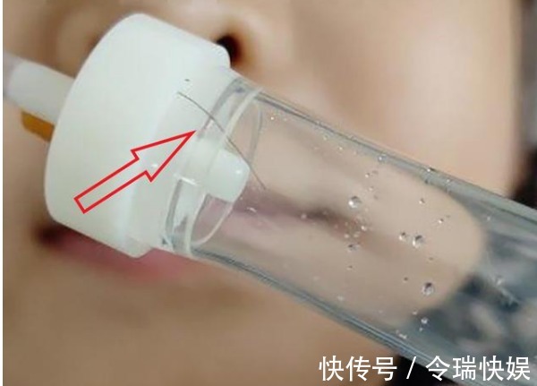 卫生|3岁幼童输液,输液管里惊现虫子,爸爸都输进我娃身体里了