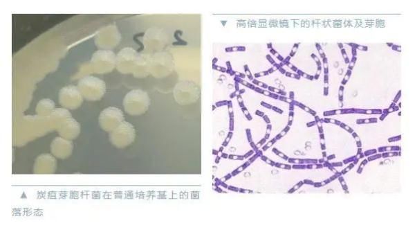 两地|警惕炭疽！近期有两地已出现病例