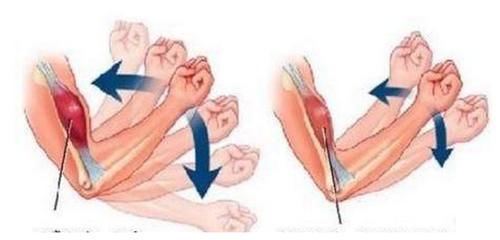 关节|“它”并不是癌症，但“它”会让人生不如死，切记要小心！