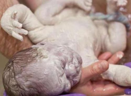 出生|宝宝出生全身裹满“奶油”,爸爸见状被“急哭”,医生看后却笑出了声