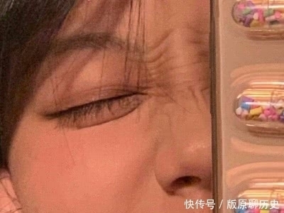 女生总爱“长黑头”怎么办?睡前养成这3习惯,轻松告别“草莓鼻”