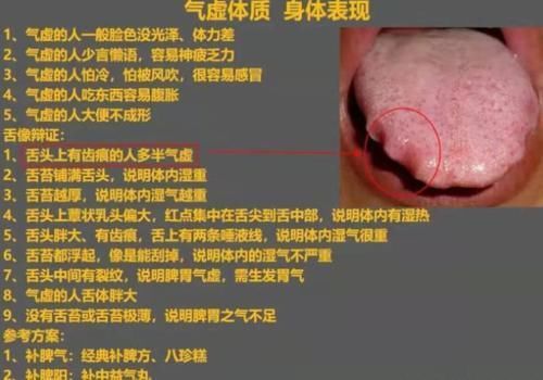 平和质|九种体质辩证:气虚、血虚、瘀血、阳虚、痰湿、阴虚,值得收藏