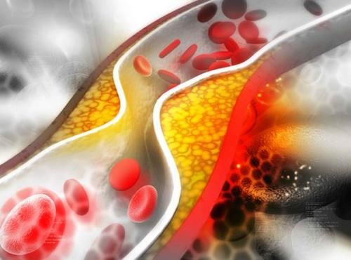 三高|日本研究发现：这种零食，或许是血管“清道夫”，常吃可预防三高