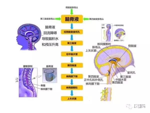 颈髓处出现脱髓鞘性病变严重可侵害脊髓和大脑 快资讯 颈髓处出现脱髓鞘性病变严重可侵害脊髓和大脑 快资讯