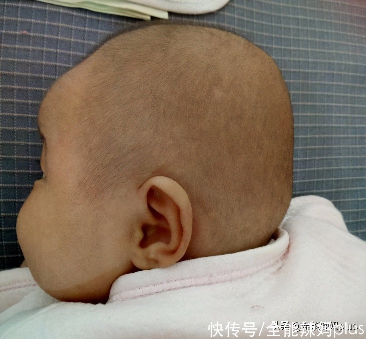 老人|“妈求求你,别给我睡扁头了”扁头有多毁娃?3张对比图告诉你