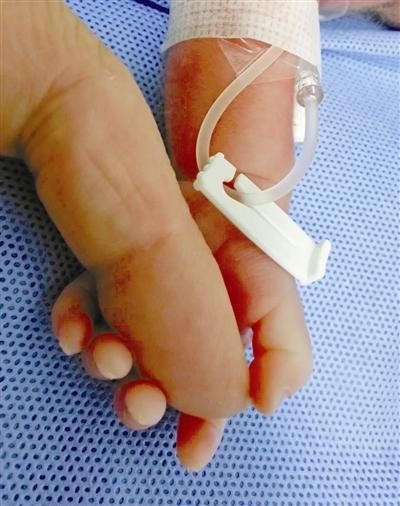 宁波市第一医院|新生儿手紧握产科医生手指的照片暖哭许多人