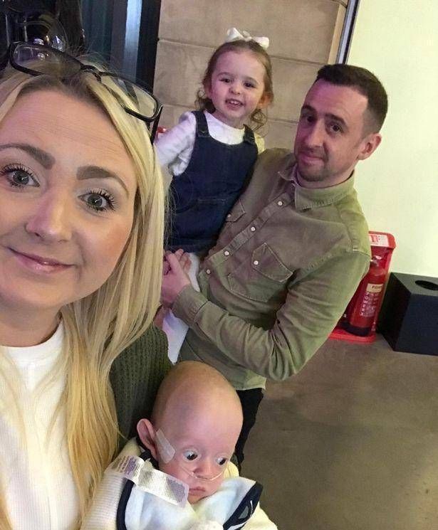 阿乐|英国妇女在怀孕21周时生下一个孩子宝宝是透明的,可以看到体内的血液流动