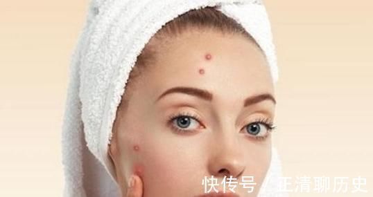 痘痘|子宫好不好看脸，若脸上没有以下5种“信号”恭喜，子宫很健康