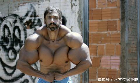 不忍直视|为了练出肌肉，巴西男子往肌肉注射燃油，如今形象不忍直视