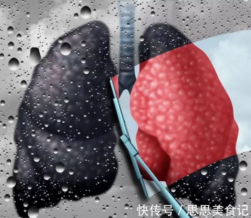 生命高危期|45岁后，步入生命高危期，想健康，保持2净、3软，坚持4勤