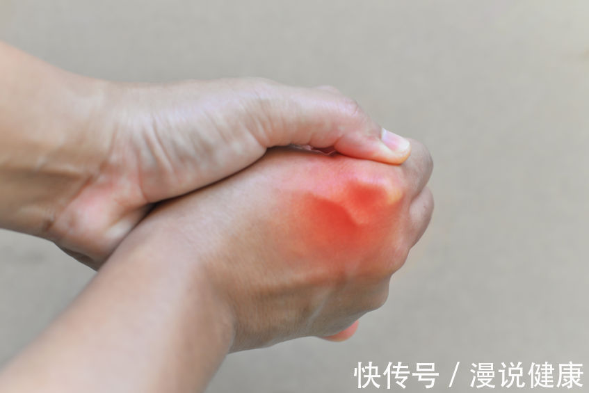 高尿酸血症|冬天一到,痛风报道?提醒:痛风患者,冬季最好别做这件事!