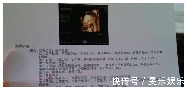 b超单|孕检时,若怀的是男宝宝,多数会有这3种孕检结果,你都符合吗?