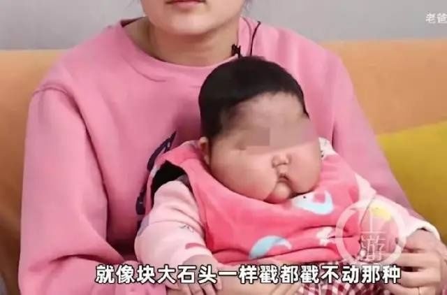 5个月大女婴抹了婴儿霜后变“大头娃娃”？