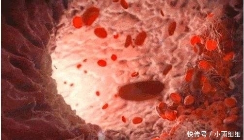 冬天用热水泡脚好处多多,但提示:2类人泡却是找病受