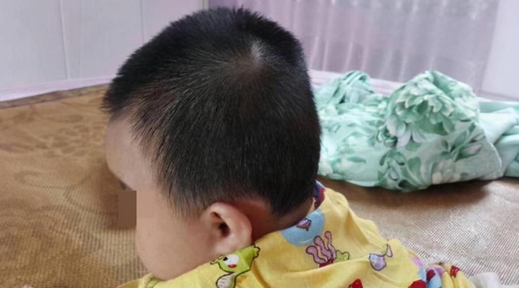 后脑勺|头型也能预测孩子的身高？拥有这类头型的娃，多半都是高个子
