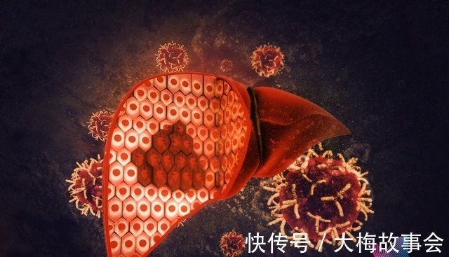 宫颈癌|为啥癌症一发现就是中晚期8个不起眼的求救信号!