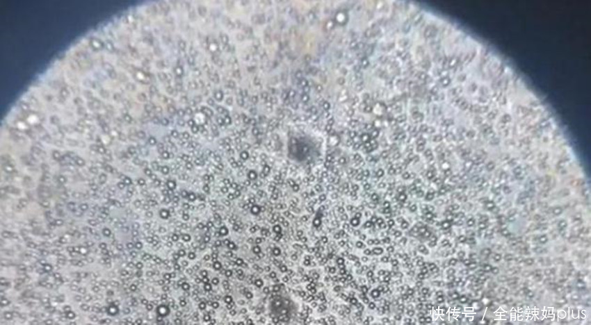 母乳|母乳是“活”的?在1000倍显微镜下长这样,纯净到令人不敢相信
